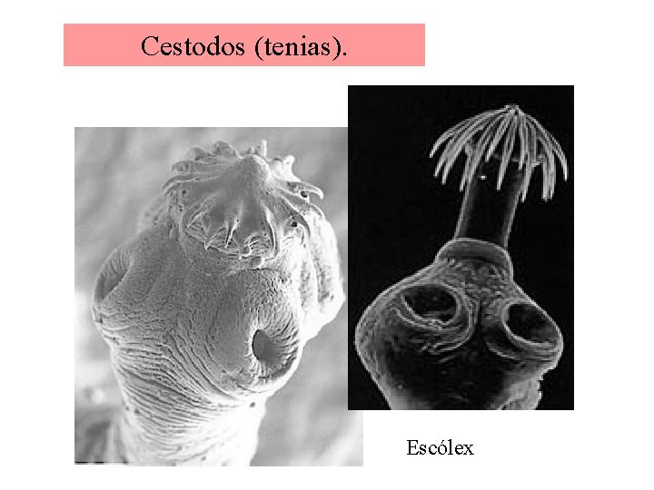 Cestodos (tenias). Escólex 