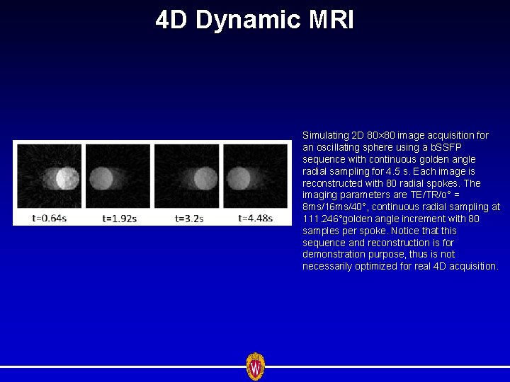4 D Dynamic MRI Simulating 2 D 80× 80 image acquisition for an oscillating