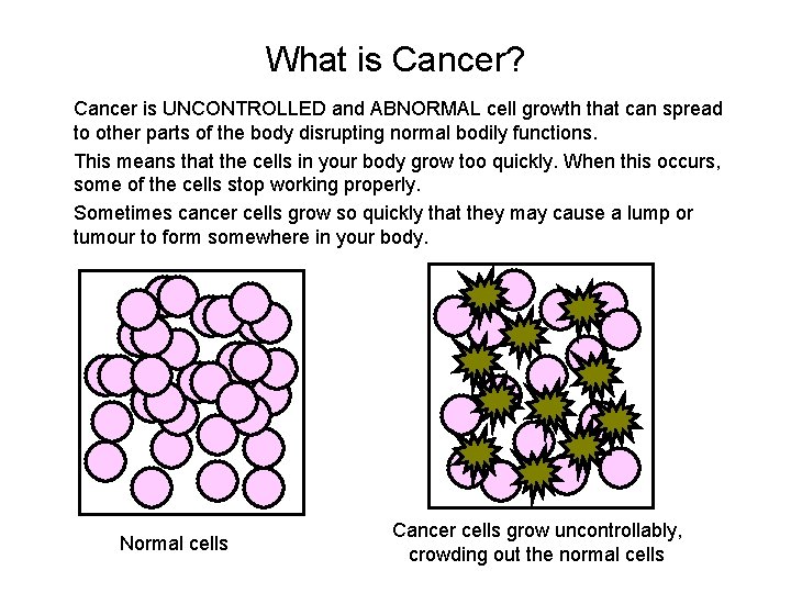 What is Cancer? Cancer is UNCONTROLLED and ABNORMAL cell growth that can spread to