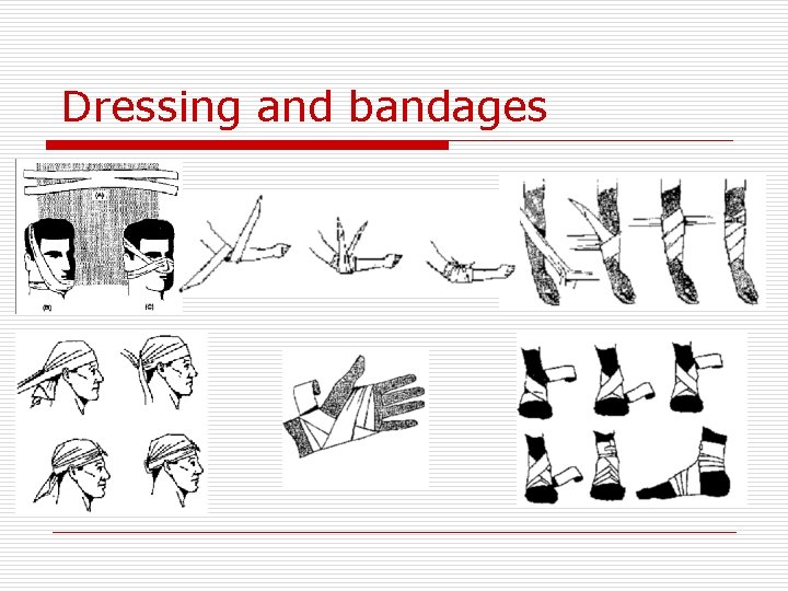 Dressing and bandages 