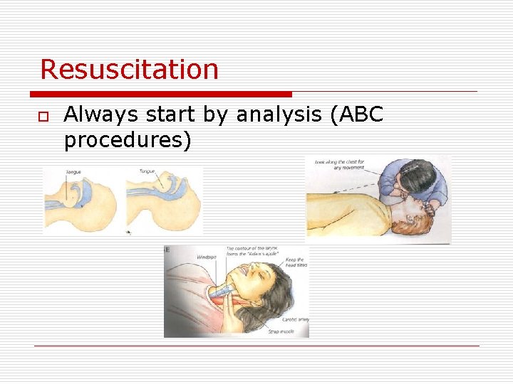 Resuscitation o Always start by analysis (ABC procedures) 