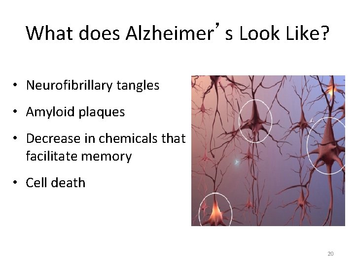 What does Alzheimer’s Look Like? • Neurofibrillary tangles • Amyloid plaques • Decrease in