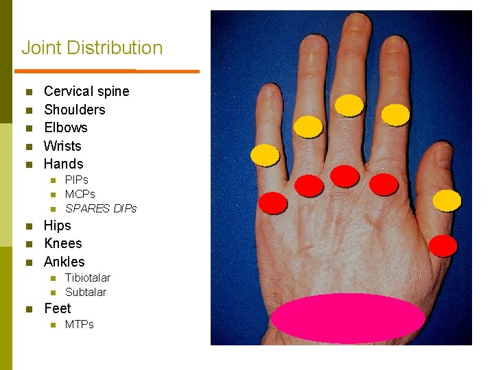 Joint Distribution n n Cervical spine Shoulders Elbows Wrists Hands n n n Hips