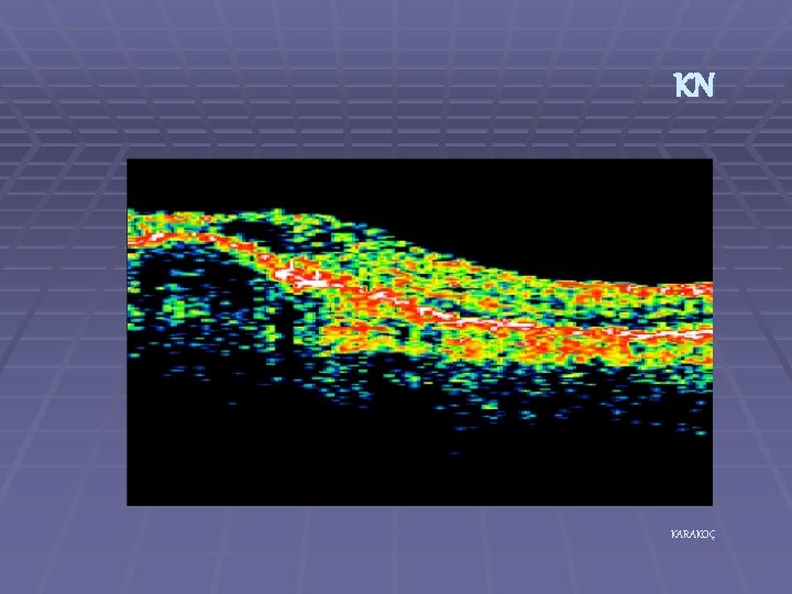 KN KARAKOÇ 
