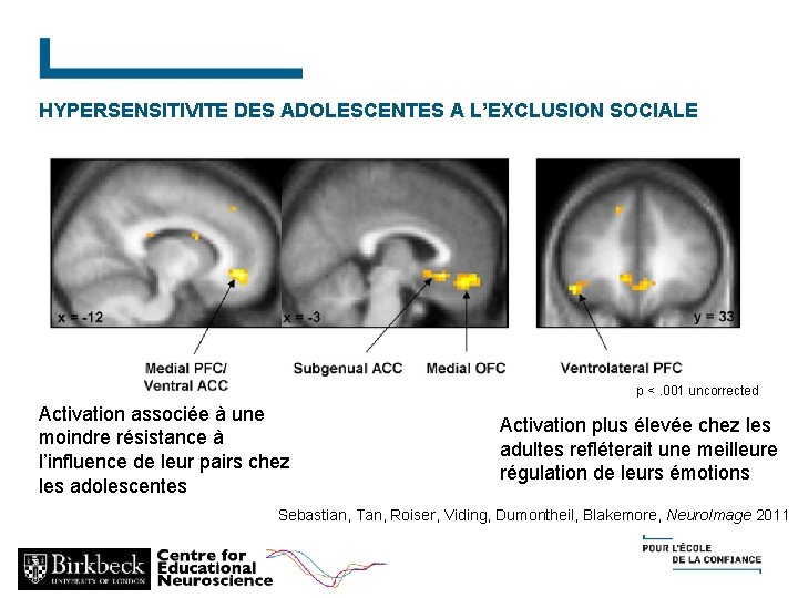 HYPERSENSITIVITE DES ADOLESCENTES A L’EXCLUSION SOCIALE p <. 001 uncorrected Activation associée à une