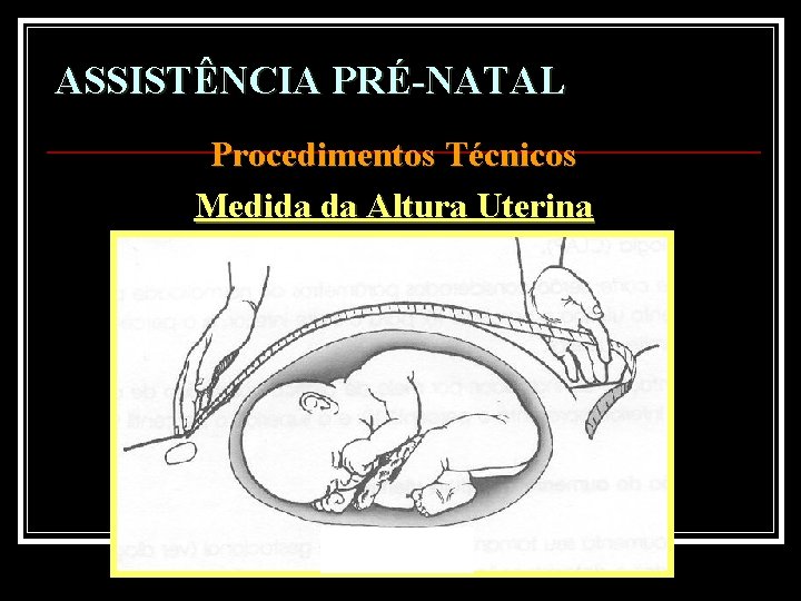 ASSISTÊNCIA PRÉ-NATAL Procedimentos Técnicos Medida da Altura Uterina 