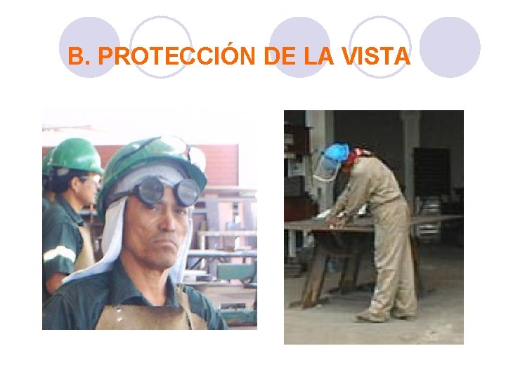 B. PROTECCIÓN DE LA VISTA 