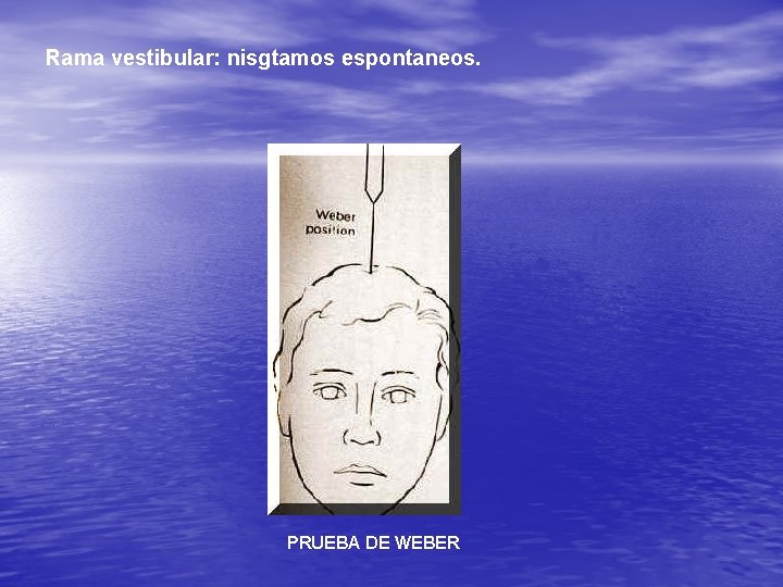 Rama vestibular: nisgtamos espontaneos. PRUEBA DE WEBER 