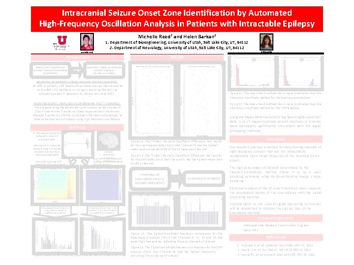 Intracranial Seizure Onset Zone Identification by Automated High-Frequency Oscillation Analysis in Patients with Intractable