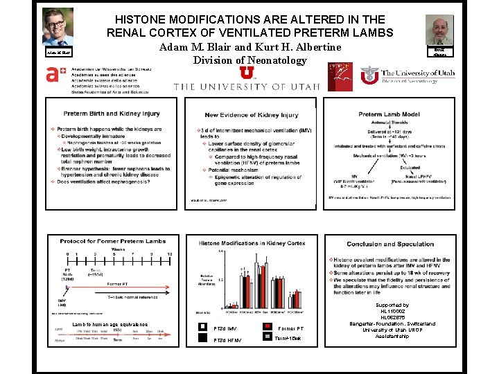 Adam M. Blair HISTONE MODIFICATIONS ARE ALTERED IN THE RENAL CORTEX OF VENTILATED PRETERM