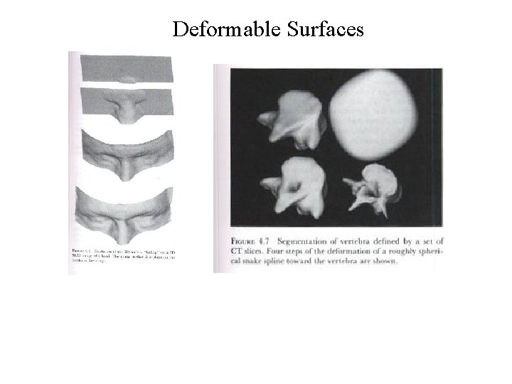 Deformable Surfaces 