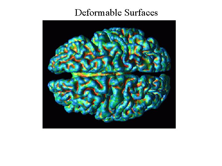 Deformable Surfaces 