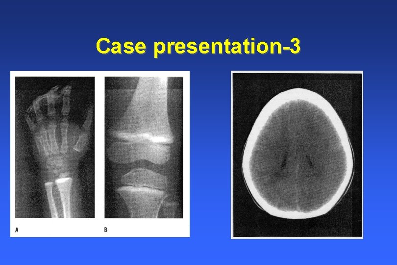 Case presentation-3 Case presentation-3