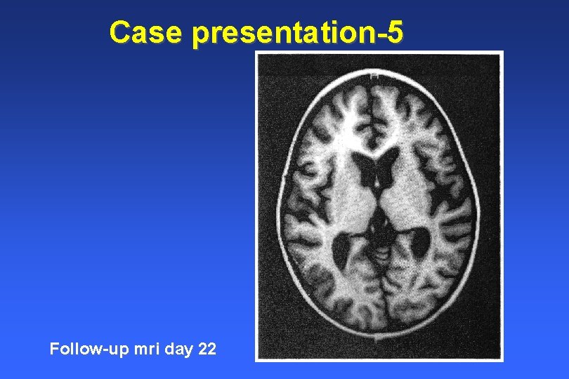 Case presentation-5 Follow-up mri day 22 Case presentation-5 Follow-up mri day 22