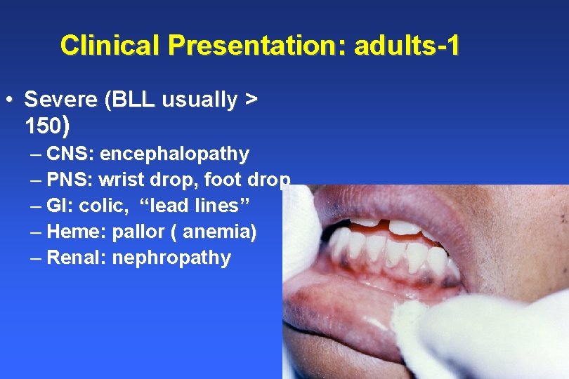 Clinical Presentation: adults-1 • Severe (BLL usually > 150) – CNS: encephalopathy – PNS: Clinical Presentation: adults-1 • Severe (BLL usually > 150) – CNS: encephalopathy – PNS: