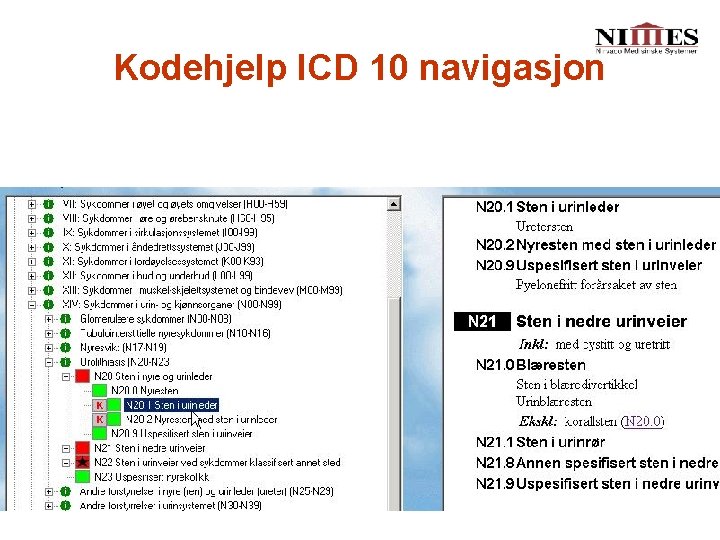 Kodehjelp ICD 10 navigasjon 
