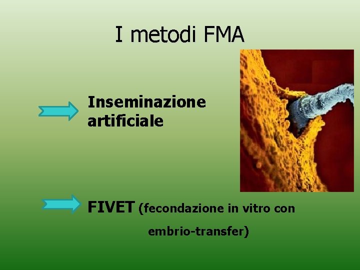 I metodi FMA Inseminazione artificiale FIVET (fecondazione in vitro con embrio-transfer) I metodi FMA Inseminazione artificiale FIVET (fecondazione in vitro con embrio-transfer)