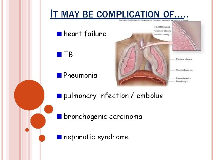 IT MAY BE COMPLICATION OF…. . heart failure TB Pneumonia pulmonary infection / embolus