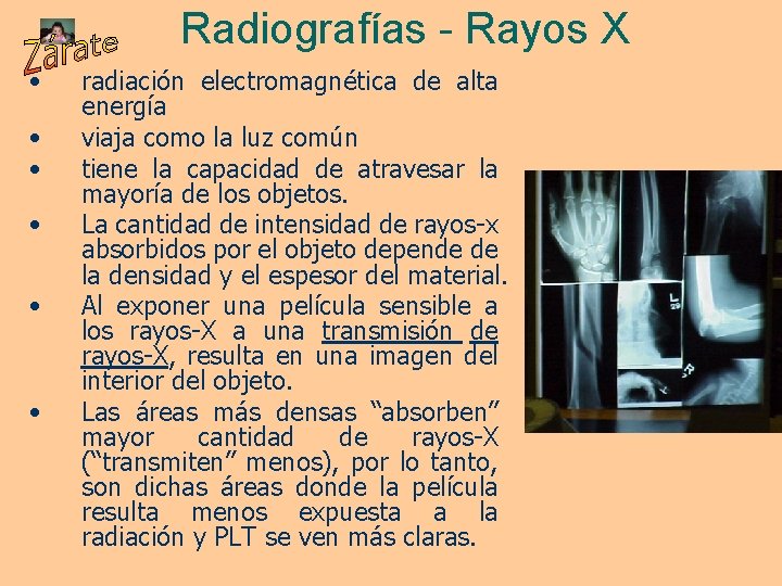 Radiografías - Rayos X • • • radiación electromagnética de alta energía viaja como