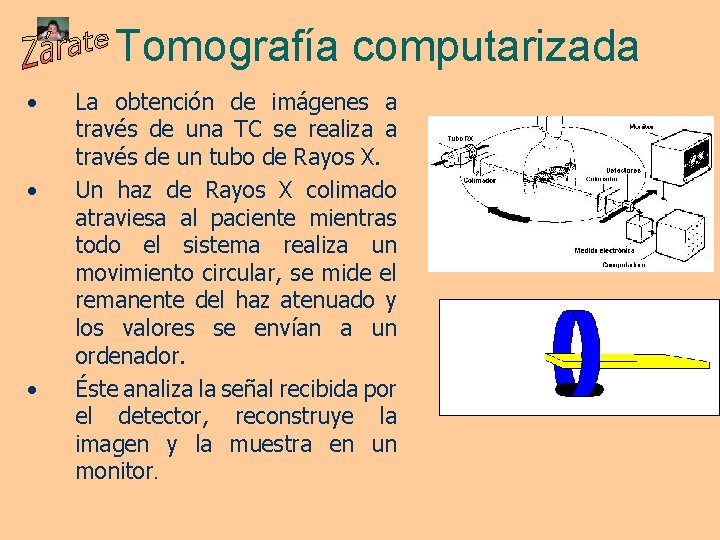 Tomografía computarizada • • • La obtención de imágenes a través de una TC