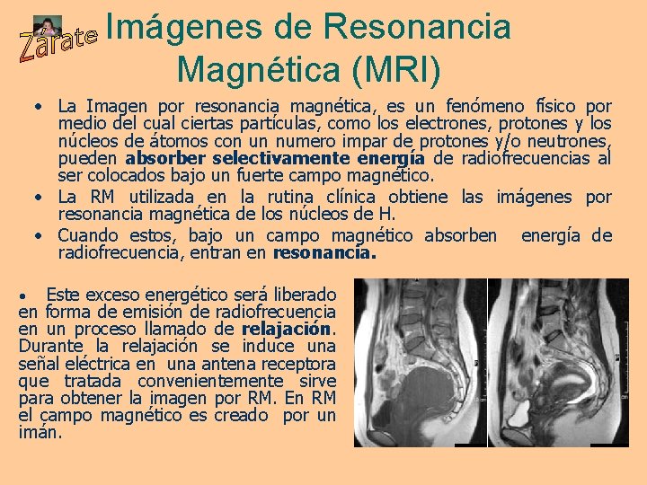 Imágenes de Resonancia Magnética (MRI) • La Imagen por resonancia magnética, es un fenómeno