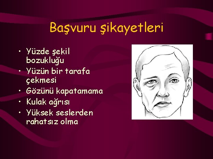 Başvuru şikayetleri • Yüzde şekil bozukluğu • Yüzün bir tarafa çekmesi • Gözünü kapatamama