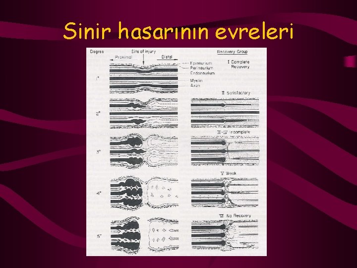 Sinir hasarının evreleri 