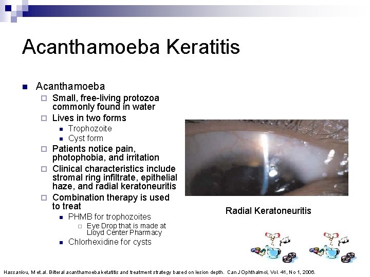 Acanthamoeba Keratitis n Acanthamoeba Small, free-living protozoa commonly found in water ¨ Lives in