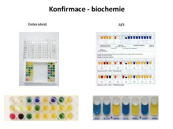 Konfirmace - biochemie Enterotest API 