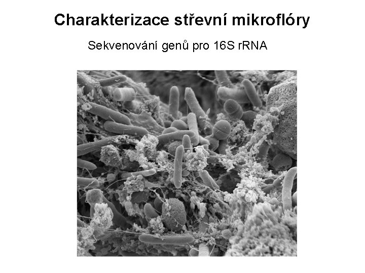 Charakterizace střevní mikroflóry Sekvenování genů pro 16 S r. RNA 