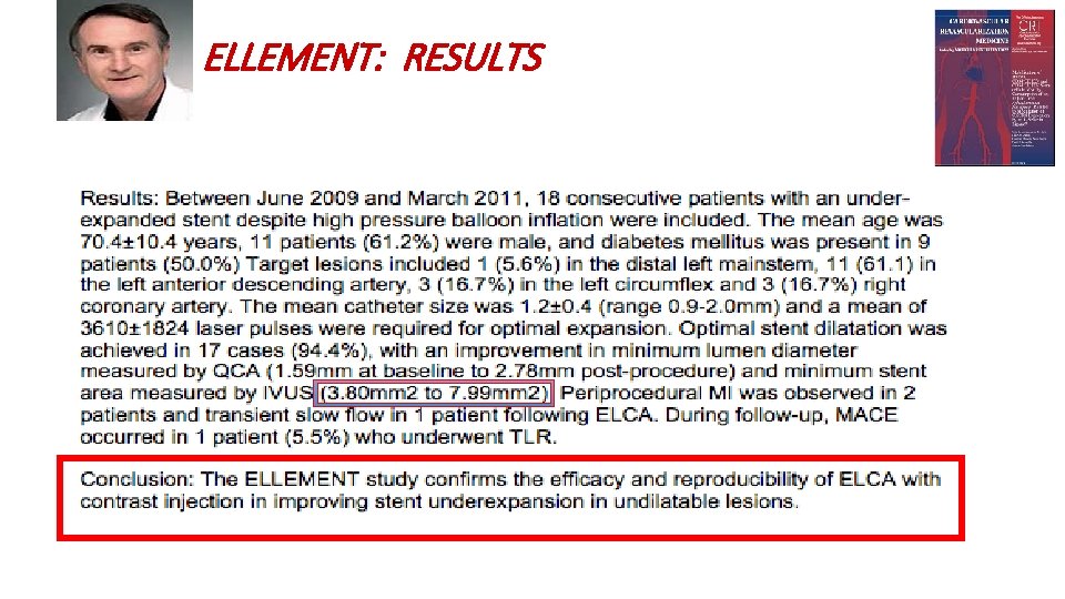 ELLEMENT: RESULTS 