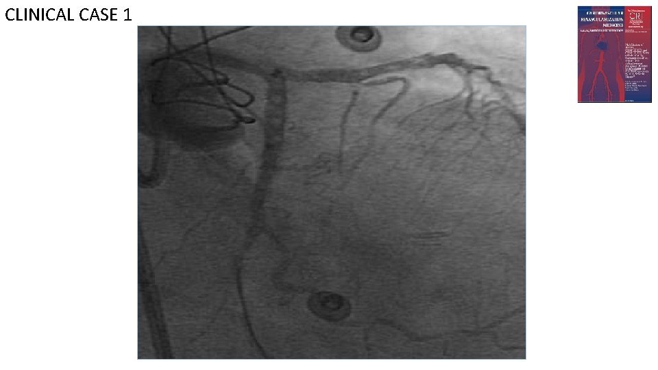 CLINICAL CASE 1 