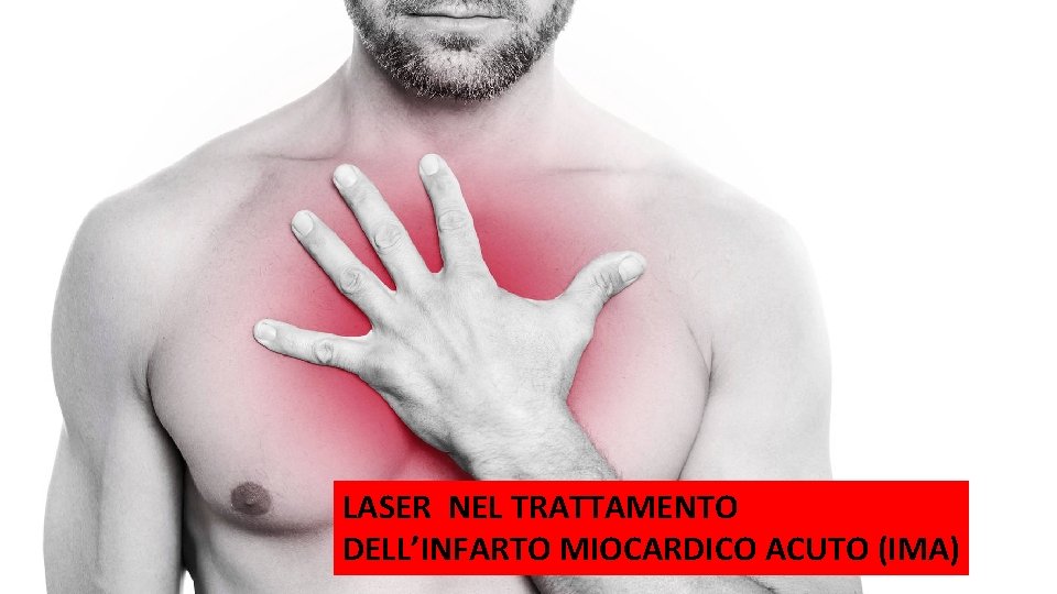 LASER NEL TRATTAMENTO DELL’INFARTO MIOCARDICO ACUTO (IMA) 