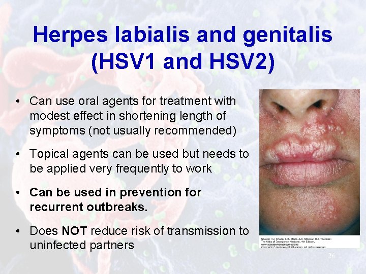 Herpes labialis and genitalis (HSV 1 and HSV 2) • Can use oral agents