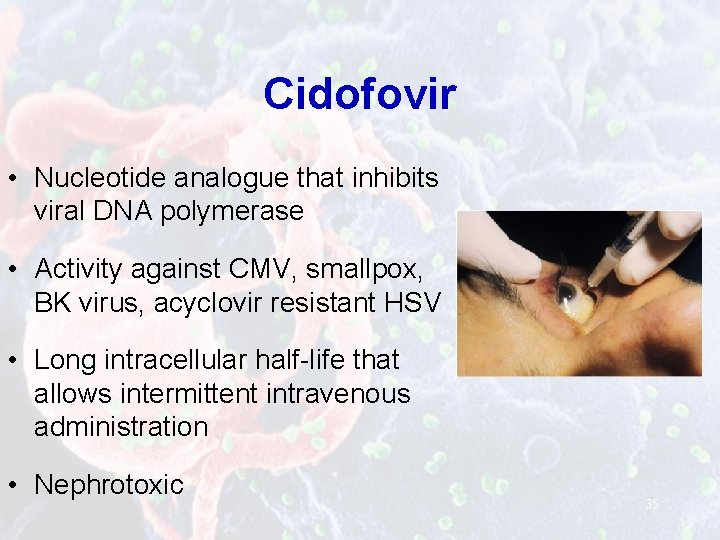 Cidofovir • Nucleotide analogue that inhibits viral DNA polymerase • Activity against CMV, smallpox,