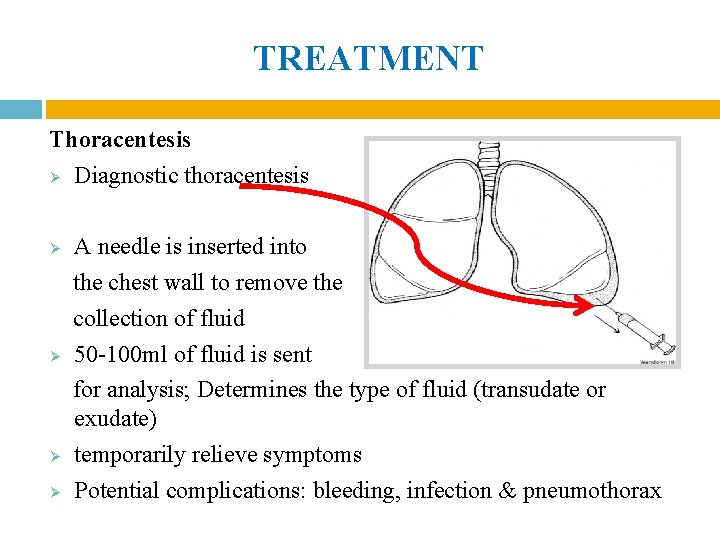 TREATMENT Thoracentesis Ø Diagnostic thoracentesis A needle is inserted into the chest wall to