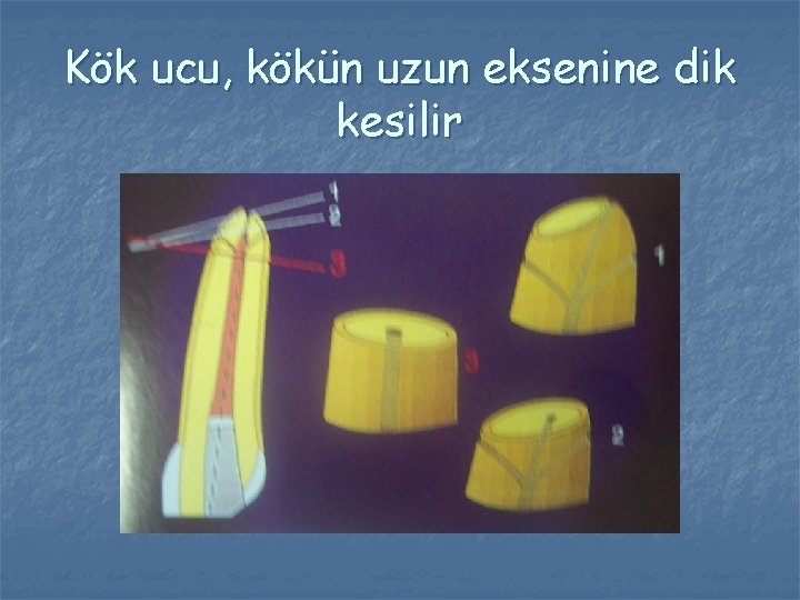 Kök ucu, kökün uzun eksenine dik kesilir Kök ucu, kökün uzun eksenine dik kesilir