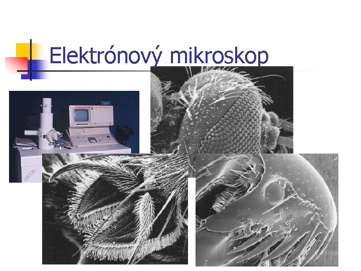 Elektrónový mikroskop Elektrónový mikroskop