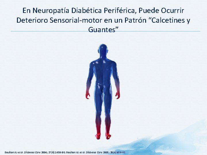 En Neuropatía Diabética Periférica, Puede Ocurrir Deterioro Sensorial-motor en un Patrón “Calcetines y Guantes”