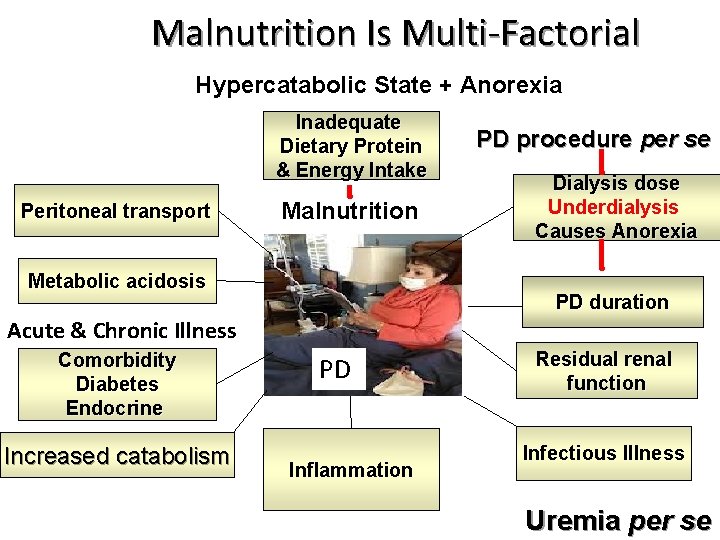 Malnutrition Is Multi-Factorial Hypercatabolic State + Anorexia Inadequate Dietary Protein & Energy Intake Peritoneal