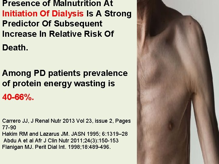 Presence of Malnutrition At Initiation Of Dialysis Is A Strong Predictor Of Subsequent Increase