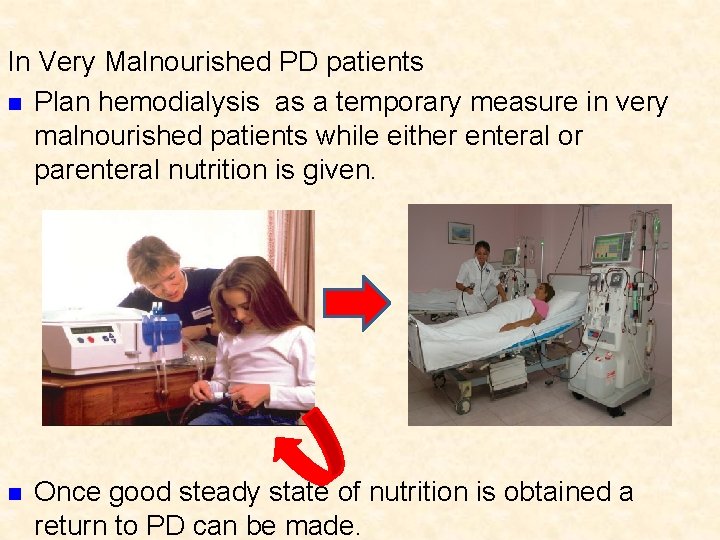 In Very Malnourished PD patients n Plan hemodialysis as a temporary measure in very