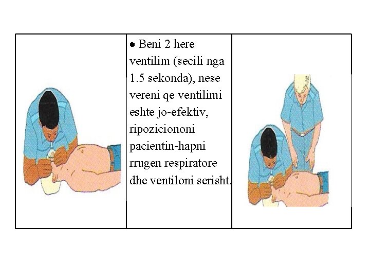  Beni 2 here ventilim (secili nga 1. 5 sekonda), nese vereni qe ventilimi