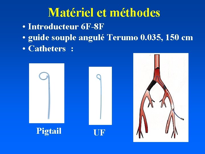 Matériel et méthodes • Introducteur 6 F-8 F • guide souple angulé Terumo 0.