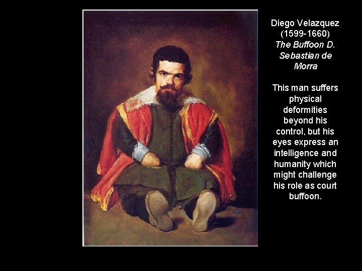 Diego Velazquez (1599 -1660) The Buffoon D. Sebastian de Morra This man suffers physical