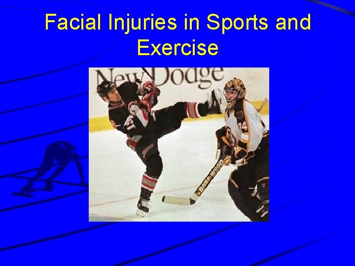 Facial Injuries in Sports and Exercise 