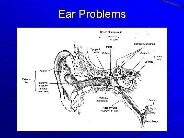 Ear Problems 