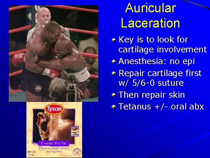 Auricular Laceration Key is to look for cartilage involvement Anesthesia: no epi Repair cartilage