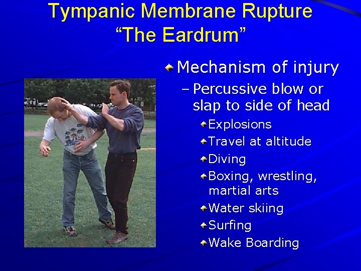Tympanic Membrane Rupture “The Eardrum” Mechanism of injury – Percussive blow or slap to