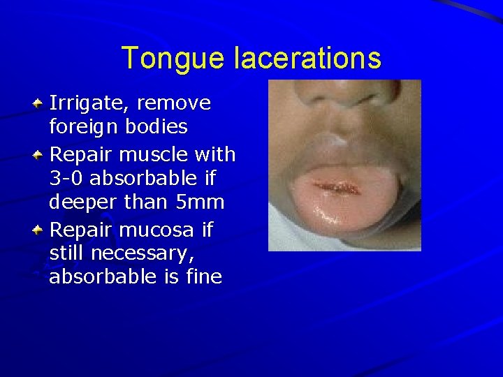 Tongue lacerations Irrigate, remove foreign bodies Repair muscle with 3 -0 absorbable if deeper